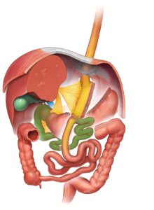 Bypass Gástrico com Anastomose Única